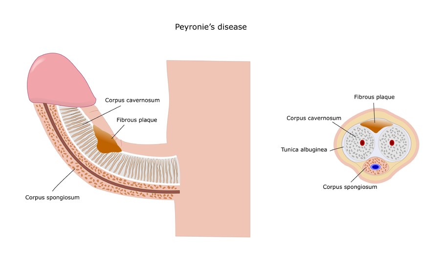 Male anatomy diagram.