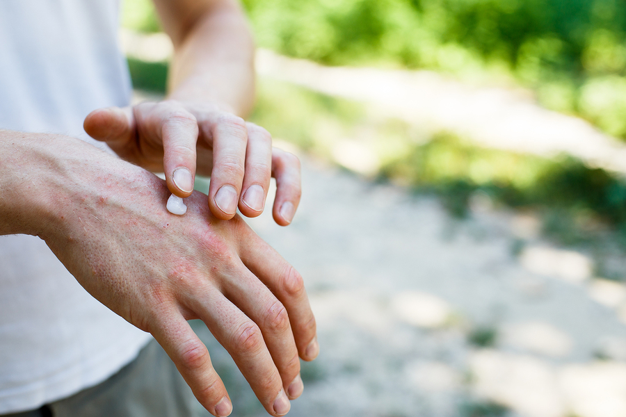 Hand cream.