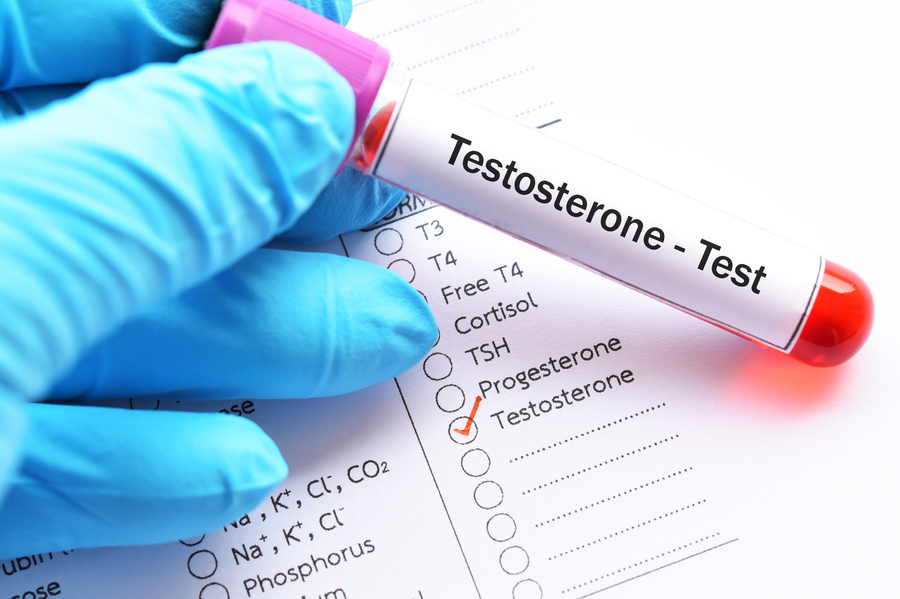 Testosterone test vial.