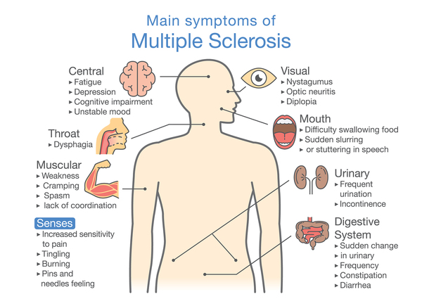 What Men With Ms Should Know About Male Impotence Online Prescription 